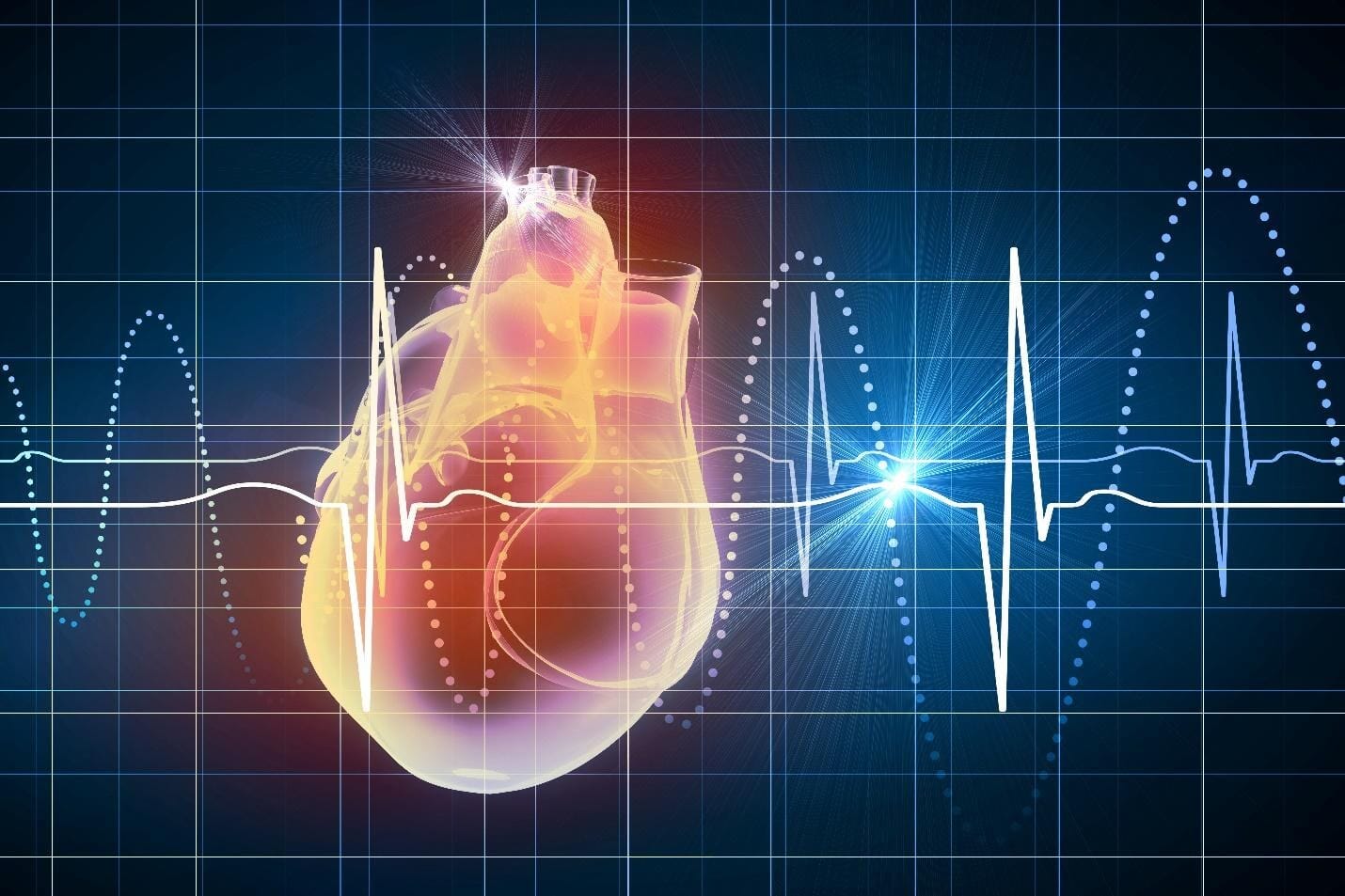 do-defibrillators-restart-a-stopped-heart-aed-usa-knowledge